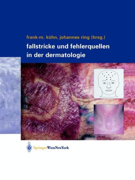 Cover for Fallstricke Und Fehlerquellen in Der Dermatologie (Hardcover Book) [2004 edition] (2004)