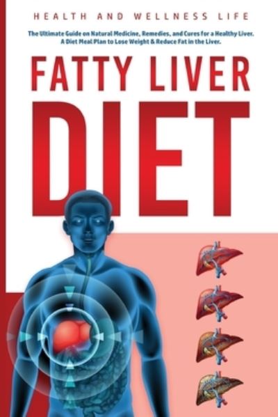 Fatty Liver Diet: The Ultimate Guide on Natural Medicine, Remedies, and Cures for a Healthy Liver. A Diet Meal Plan to Lose Weight & Reduce Fat in the Liver.: The Ultimate Guide on Natural Medicine, Remedies, and Cures for a Healthy Liver. A Diet Meal Pla - Health And Wellness Life - Books - Trebol Publishing LLC - 9781087969176 - May 27, 2021