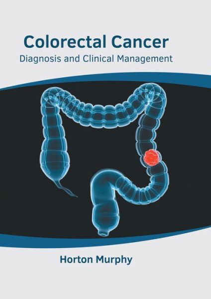 Colorectal Cancer - Horton Murphy - Książki - States Academic Press - 9781639891177 - 27 września 2022