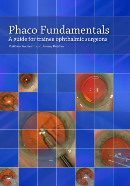 Cover for Matthew Anderson · Phaco Fundamentals: A Guide for Trainee Ophthalmic Surgeons (Paperback Book) (2011)