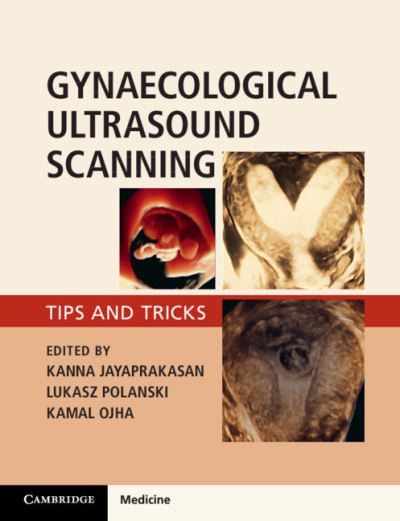 Cover for Kanna Jayaprakasan · Gynaecological Ultrasound Scanning: Tips and Tricks (Paperback Book) (2020)