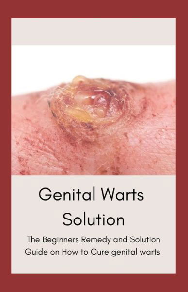 Cover for Independently Published · Genital Warts Solution (Paperback Book) (2021)