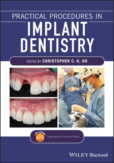 Cover for CCK Ho · Practical Procedures in Implant Dentistry (Pocketbok) (2021)