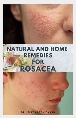 Cover for Dr Elizabeth David · Natural and Home Remedies for Rosacea (Paperback Book) (2020)