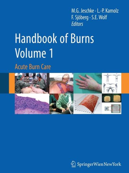 Cover for Handbook of Burns Volume 1: Acute Burn Care (Paperback Book) [Softcover reprint of the original 1st ed. 2012 edition] (2016)