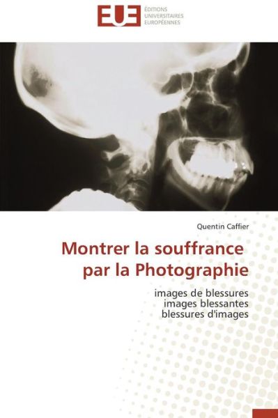 Cover for Quentin Caffier · Montrer La Souffrance Par La Photographie: Images De Blessures Images Blessantes Blessures D'images (Paperback Book) [French edition] (2018)