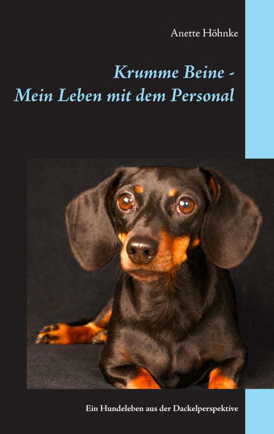 Cover for Höhnke · Krumme Beine Mein Leben mit dem (Book)