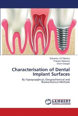 Cover for Behera · Characterisation of Dental Impla (Book) (2018)