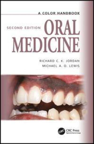 Cover for Michael Lewis · Oral Medicine - Medical Color Handbook Series (Paperback Book) (2018)