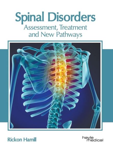 Cover for Rickon Hamill · Spinal Disorders: Assessment, Treatment and New Pathways (Hardcover Book) (2019)