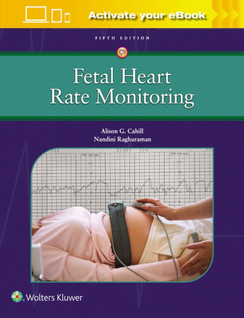 Fetal Heart Rate Monitoring - Alison Cahill - Böcker - Wolters Kluwer Health - 9781975216184 - 30 december 2024