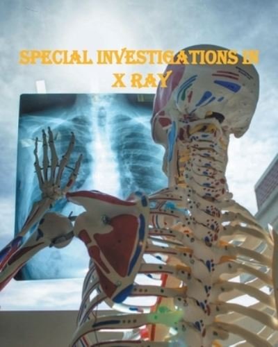 Cover for Maajid Ud Mohi · Special Investigations in X Ray (Taschenbuch) (2020)