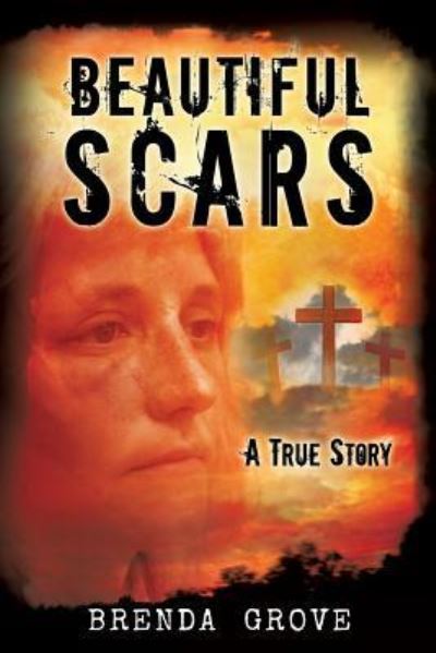 Cover for Brenda Grove · Beautiful Scars (Paperback Book) (2017)