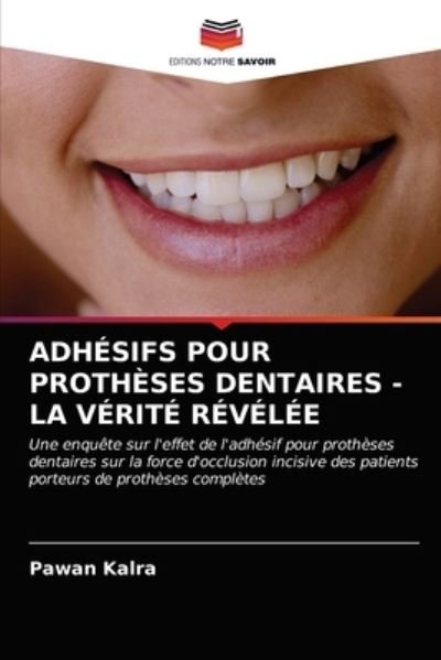Cover for Pawan Kalra · Adhesifs Pour Protheses Dentaires - La Verite Revelee (Taschenbuch) (2021)
