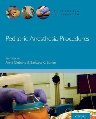 Pediatric Anesthesia Procedures - Anesthesia Illustrated -  - Kirjat - Oxford University Press Inc - 9780190685188 - keskiviikko 31. maaliskuuta 2021