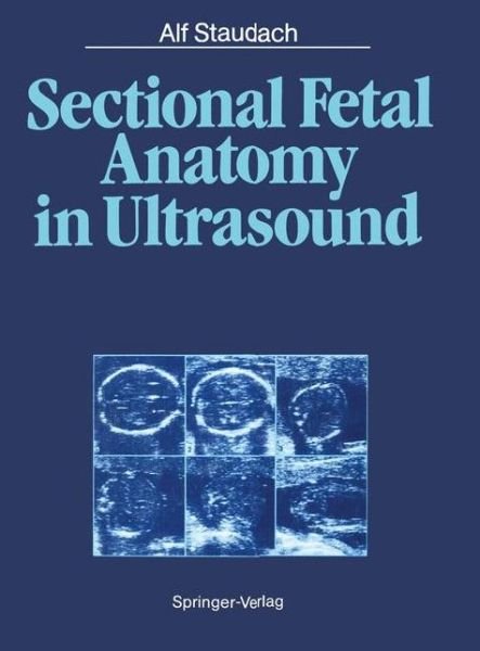 Cover for Alf Staudach · Sectional Fetal Anatomy in Ultrasound (Pocketbok) [Softcover reprint of the original 1st ed. 1987 edition] (2012)