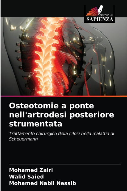 Cover for Mohamed Zairi · Osteotomie a ponte nell'artrodesi posteriore strumentata (Paperback Book) (2021)