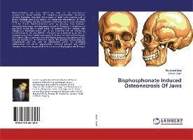 Cover for Iqbal · Bisphosphonate Induced Osteonecro (Book)