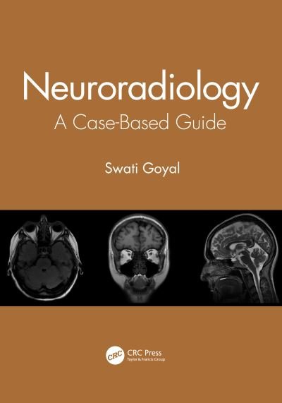 Cover for Goyal, Swati (Gandhi Medical College, Bhopal, India) · Neuroradiology: A Case-Based Guide (Paperback Bog) (2020)
