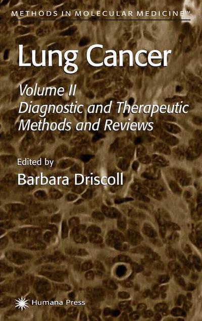 Cover for Barbara Driscoll · Lung Cancer: Volume 2: Diagnostic and Therapeutic Methods and Reviews - Methods in Molecular Medicine (Paperback Book) [Softcover reprint of the original 1st ed. 2003 edition] (2013)