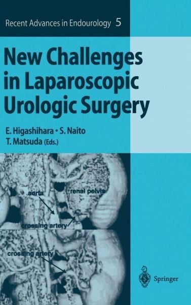 E Higashihara · New Challenges in Laparoscopic Urologic Surgery - Recent Advances in Endourology (Hardcover Book) [2004 edition] (2003)