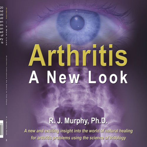 Arthritis-a New Look: Arthritic Indicators As Seen in the Eyes - Raymond Murphy - Livros - AuthorHouse - 9781425938192 - 21 de julho de 2006