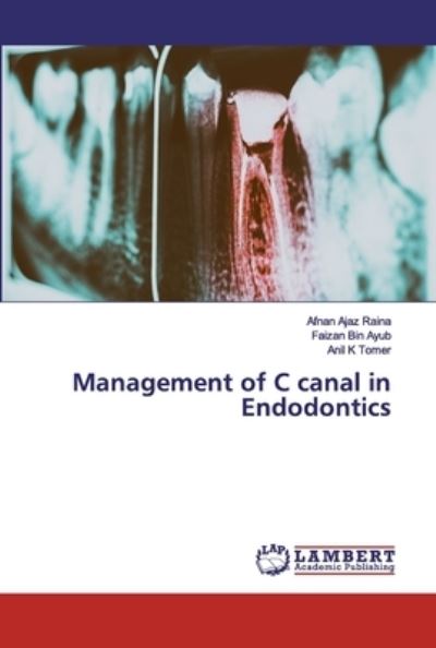 Cover for Raina · Management of C canal in Endodont (Book) (2019)