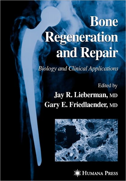 Cover for Jay R Lieberman · Bone Regeneration and Repair: Biology and Clinical Applications (Paperback Book) [Softcover reprint of hardcover 1st ed. 2005 edition] (2010)