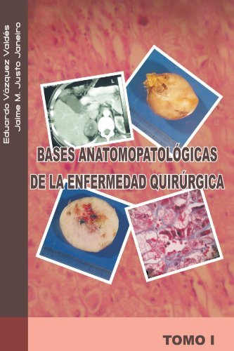 Cover for Eduardo Vázquez V. · Bases Anatomopatológicas De La Enfermedad Quirúrgica: Tomo I (Taschenbuch) [Spanish edition] (2011)