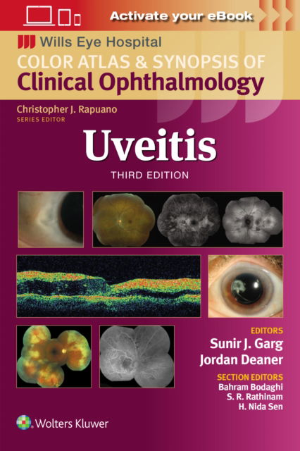 Uveitis - Wills Eye Institute Atlas Series - Sunir J. Garg - Books - Wolters Kluwer Health - 9781975215194 - July 10, 2024