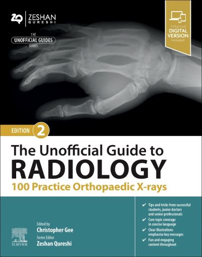 The Unofficial Guide to Radiology: 100 Practice Orthopaedic X-rays - Unofficial Guides - - Books - Elsevier Health Sciences - 9780443109195 - September 25, 2023