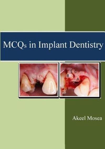 Cover for Akeel Mosea · MCQS in Implant Dentistry (Paperback Book) (2016)