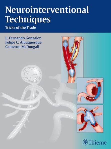 Neurointerventional Techniques: Tricks of the Trade - Fernando Gonzalez - Böcker - Thieme Medical Publishers Inc - 9781684202195 - 4 mars 2019