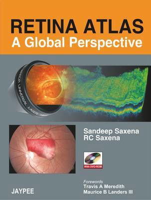 Cover for Sandeep Saxena · Retina Atlas - A Global Perspective (Bok) (2008)