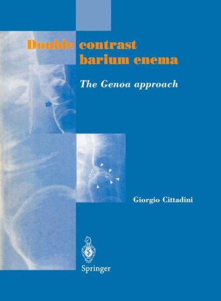 Cover for Giorgio Cittadini · Double contrast barium enema: The Genoa approach (Paperback Book) [Softcover reprint of the original 1st ed. 1998 edition] (2012)