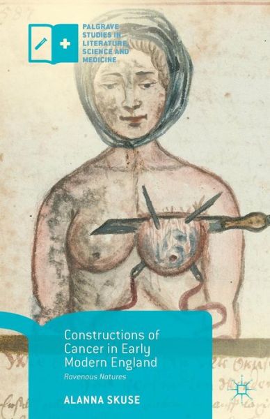 Cover for Alanna Skuse · Constructions of Cancer in Early Modern England: Ravenous Natures - Palgrave Studies in Literature, Science and Medicine (Paperback Book) [1st ed. 2015 edition] (2015)