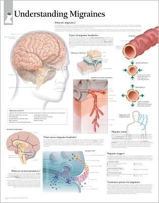 Understanding Migraines Paper Poster - Scientific Publishing - Merchandise - Scientific Publishing - 9781932922196 - December 1, 2008