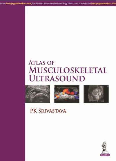 Cover for PK Srivastava · Atlas of Musculoskeletal Ultrasound (Hardcover Book) (2014)