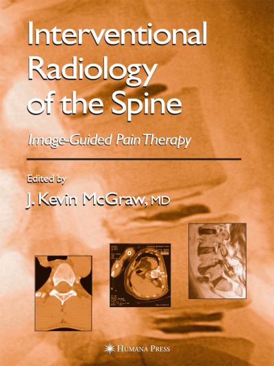 Interventional Radiology of the Spine: Image-Guided Pain Therapy - J Kevin Mcgraw - Books - Humana Press Inc. - 9781617374197 - November 5, 2010