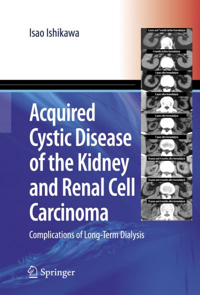 Cover for Isao Ishikawa · Acquired Cystic Disease of the Kidney and Renal Cell Carcinoma: Complication of Long-Term Dialysis (Pocketbok) [Softcover reprint of the original 1st ed. 2007 edition] (2016)