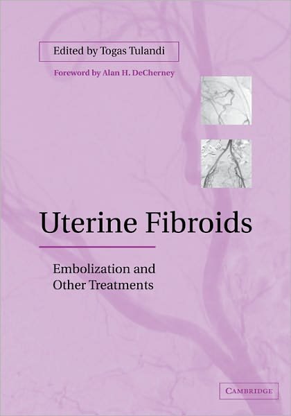 Cover for Togas Tulandi · Uterine Fibroids: Embolization and other Treatments (Paperback Book) (2011)