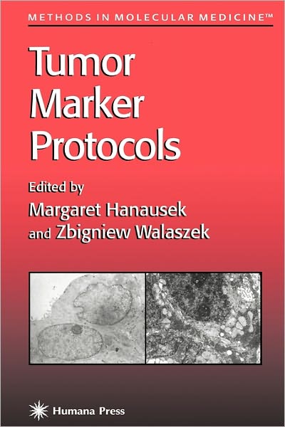 Cover for Margaret Hanausek · Tumor Marker Protocols - Methods in Molecular Medicine (Paperback Book) [1st ed. Softcover of orig. ed. 1998 edition] (2010)