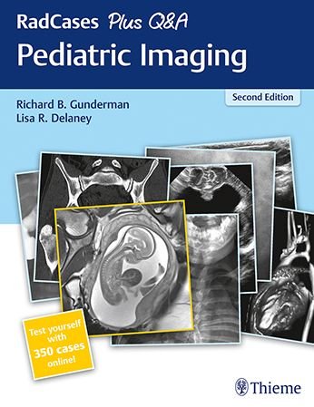 Cover for Richard B. Gunderman · RadCases Plus Q&amp;A Pediatric Imaging - Radcases Plus Q&amp;A (Paperback Book) (2019)