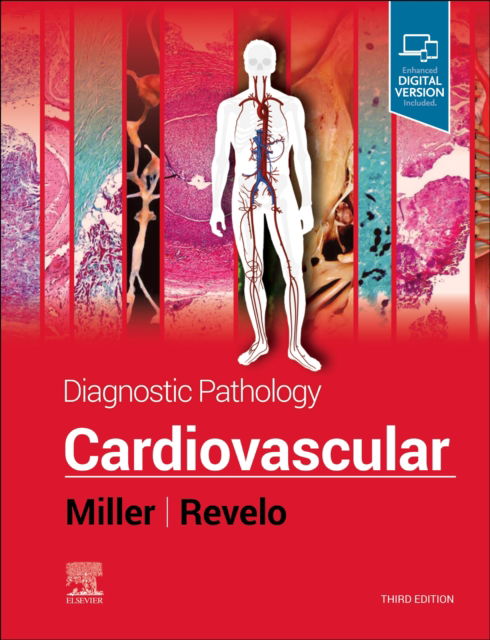Cover for Miller, Dylan V. (Dylan V. Miller, MD, Professor (Clinical), Department of Pathology, University of Utah School of Medicine, Director of Electron Microscopy and Immunostains, Intermountain Central Laboratory, Salt Lake City, Utah) · Diagnostic Pathology: Cardiovascular - Diagnostic Pathology (Hardcover Book) (2023)
