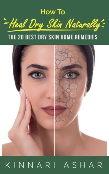 Cover for Kinnari Ashar · How to Heal Dry Skin Naturally (Book) (2022)