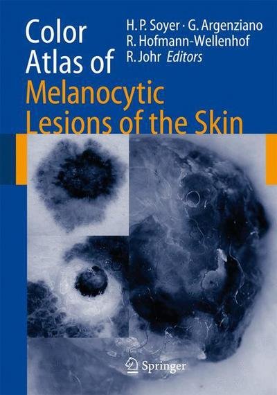 Cover for H P Soyer · Color Atlas of Melanocytic Lesions of the Skin (Paperback Book) [Softcover reprint of hardcover 1st ed. 2007 edition] (2010)