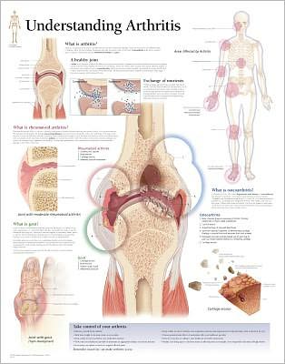 Cover for Scientific Publishing · Understanding Arthritis Laminated Poster (Poster) (2006)