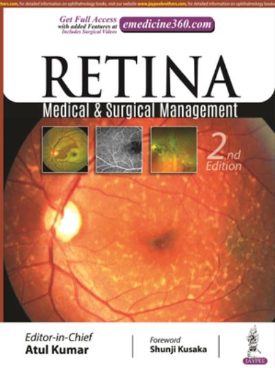 Cover for Atul Kumar · Retina: Medical &amp; Surgical Management (Hardcover Book) [2 Revised edition] (2021)