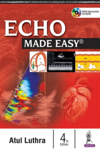 Cover for Atul Luthra · Echo Made Easy (Paperback Book) [4 Revised edition] (2016)