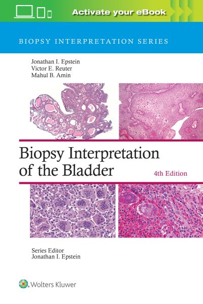 Cover for Jonathan I. Epstein · Biopsy Interpretation of the Bladder: Print + eBook with Multimedia - Biopsy Interpretation Series (Hardcover Book) (2023)